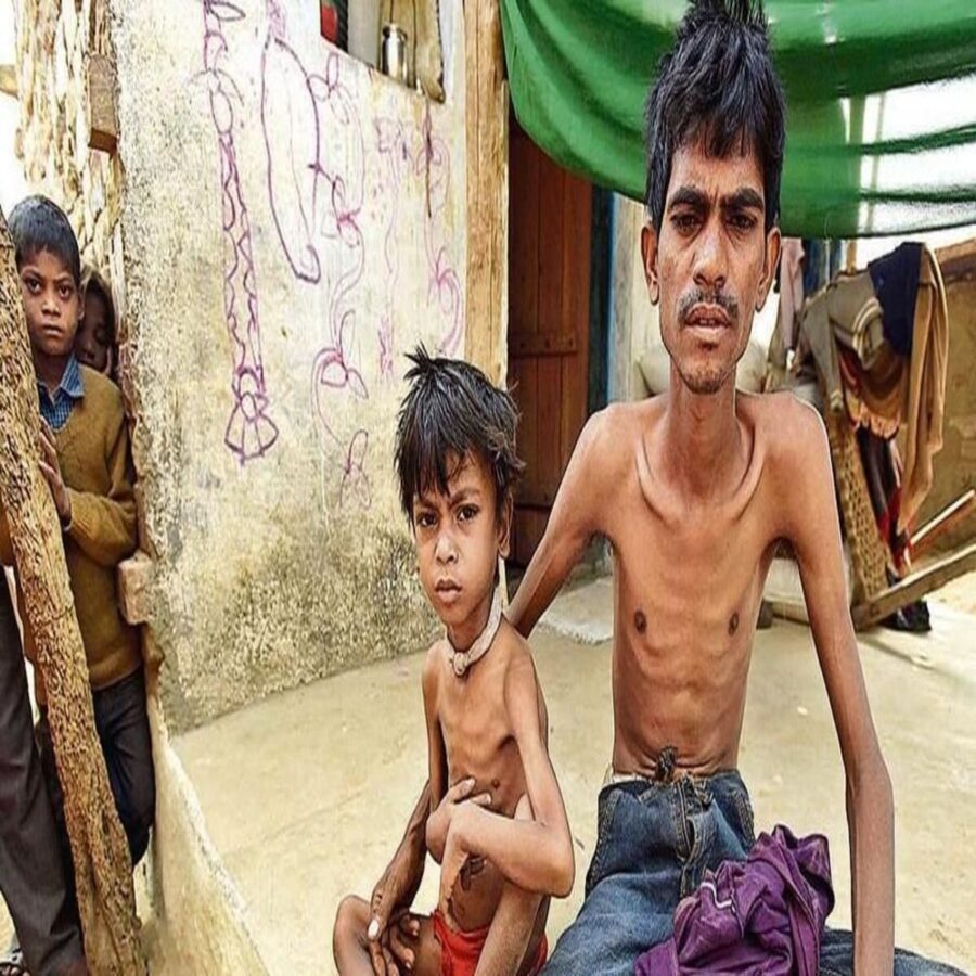बक्सर: टीबी के मरीज